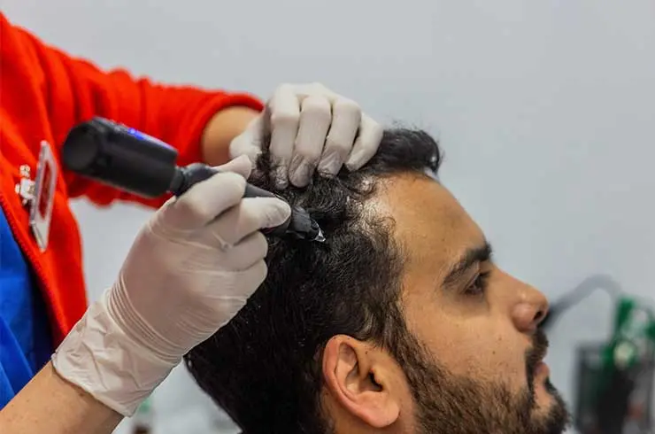 mesoterapia capilar en badajoz