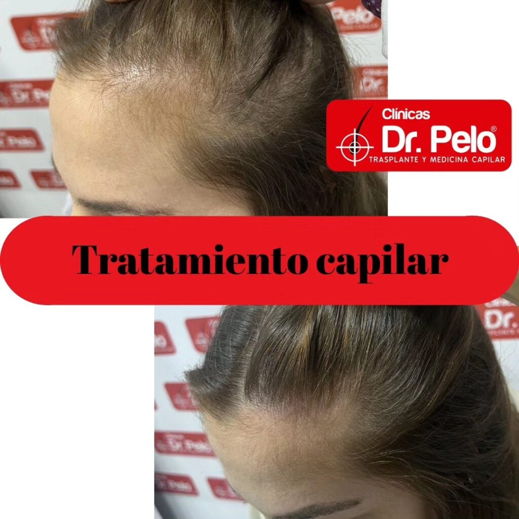 TRATAMIENTO-CAPILAR-MUJER