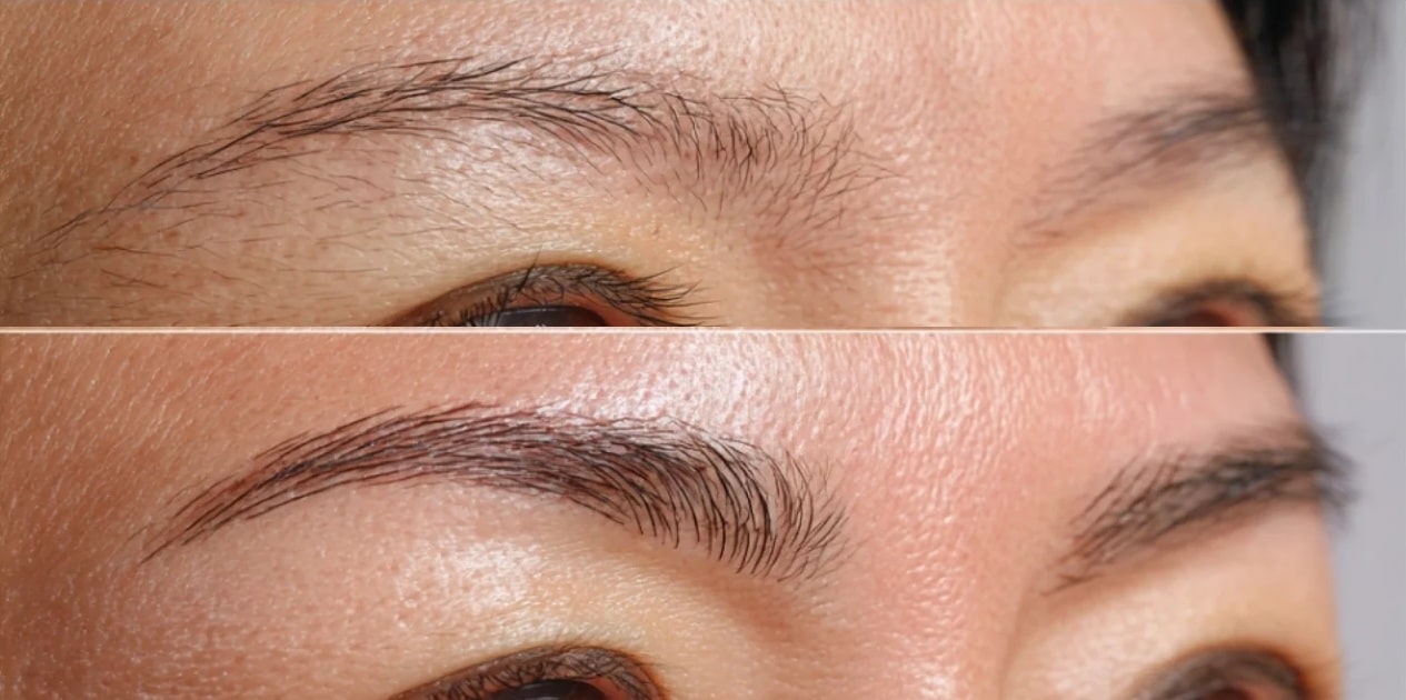 Estructuración y repoblación estética
